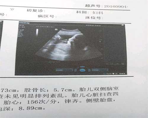 井冈山爱子之家助孕：孕妇过安检时，辐射会影响胎儿吗
