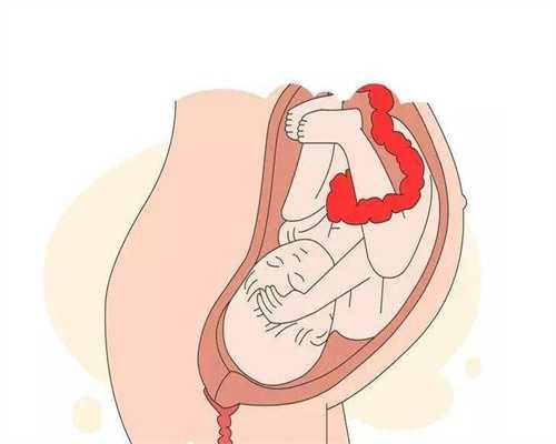 育儿说：爱子之家助孕五个月的肚子应该有多大需要注