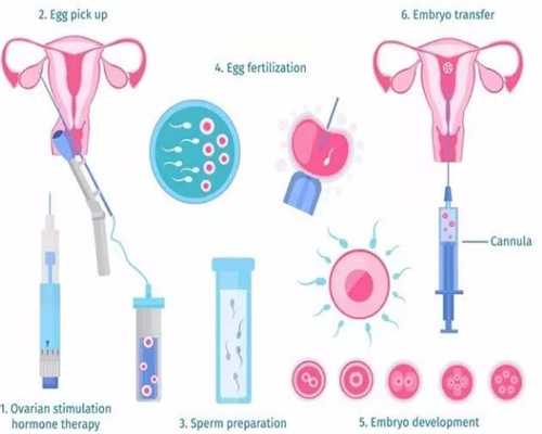 代孕选男女，为老公代孕_分析输卵管粘连能代孕