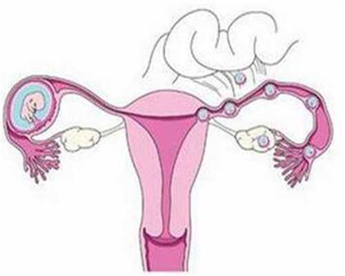 想生不能生的女性，想了解不孕7项检查有哪些？