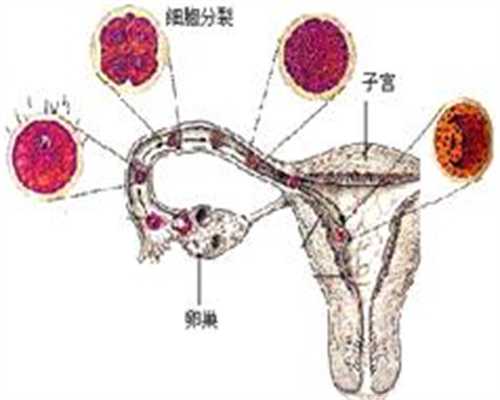 试管代妈好吗_卵巢早衰是由什么原因引起的？