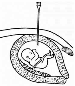 福建供卵试管婴儿哪里做，闰月清宫图怎么看这个表横向的1~12是代表女性怀孕