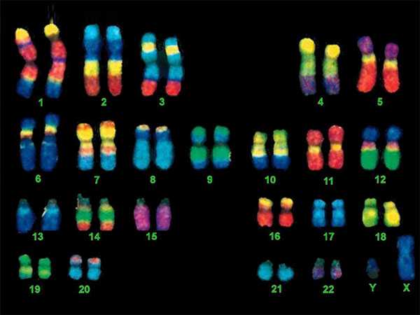 供卵试管价格查询，45XO染色体形成的原因及常见的症状介绍